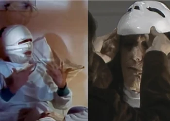 A Viagem: Mascarado passa por cirurgia plástica para reconstruir rosto desfigurado e resultado faz ele chorar